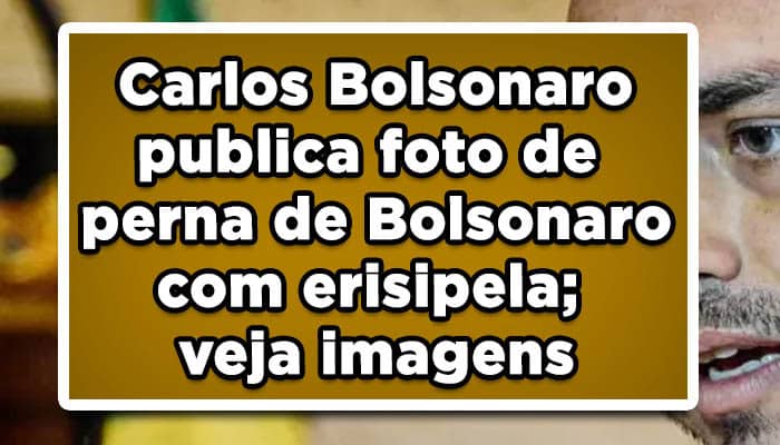 Carlos Bolsonaro publica foto de Bolsonaro com erisipela