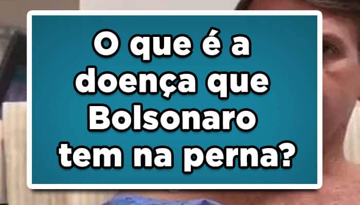 O que é a doença que Bolsonaro tem na perna? Entenda